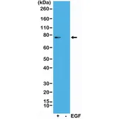 Anti-p90 RSK1 (phospho Thr359/Ser363) antibody [RM233] used in Western Blot (WB). GTX33600