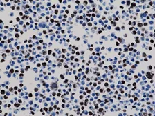 Anti-6X His tag antibody [RM146] used in Immunocytochemistry/ Immunofluorescence (ICC/IF). GTX33607