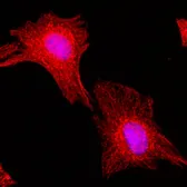 Anti-alpha Tubulin antibody [RM113] used in Immunocytochemistry/ Immunofluorescence (ICC/IF). GTX33609
