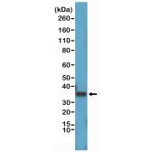 Anti-Cyclin D1 antibody [RM241] used in Western Blot (WB). GTX33611