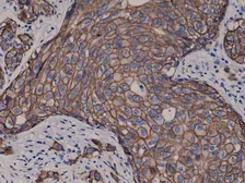 Anti-Her2 / ErbB2 antibody [RM228] used in IHC (Paraffin sections) (IHC-P). GTX33616