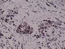 Anti-HIF1 alpha antibody [RM242] used in IHC (Paraffin sections) (IHC-P). GTX33617