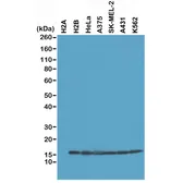 Anti-Histone H2B antibody [RM230] used in Western Blot (WB). GTX33619