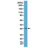 Anti-Macro H2A.1 antibody [RM248] used in Western Blot (WB). GTX33622