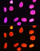 Anti-Histone H3R2me2 (Symmetric Di-methyl Arg2) antibody used in Immunocytochemistry/ Immunofluorescence (ICC/IF). GTX33905
