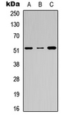 Anti-Factor IX antibody used in Western Blot (WB). GTX33954