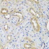 Anti-IL10 antibody used in IHC (Paraffin sections) (IHC-P). GTX33963