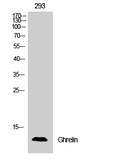 Anti-Ghrelin antibody used in Western Blot (WB). GTX33964