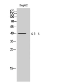 Anti-GNB5 antibody used in Western Blot (WB). GTX33965