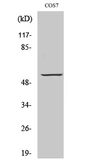 Anti-GPR101 antibody used in Western Blot (WB). GTX33969