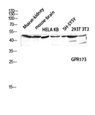 Anti-SREB3 antibody used in Western Blot (WB). GTX33974