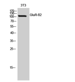 Anti-GRID2 antibody used in Western Blot (WB). GTX33977