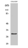Anti-HLA-DOA antibody used in Western Blot (WB). GTX33991