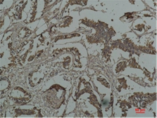 Anti-HSP27 antibody [Mix-mA] used in IHC (Paraffin sections) (IHC-P). GTX34000