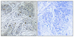 Anti-ID4 antibody used in IHC (Paraffin sections) (IHC-P). GTX34004