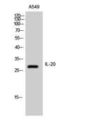 Anti-IL20 antibody used in Western Blot (WB). GTX34011