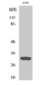 Anti-Inhibin beta C chain antibody used in Western Blot (WB). GTX34016