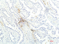 Anti-JAK1 antibody [7G6] used in IHC (Paraffin sections) (IHC-P). GTX34019