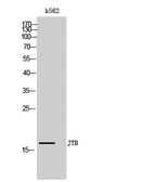 Anti-JTB antibody used in Western Blot (WB). GTX34021