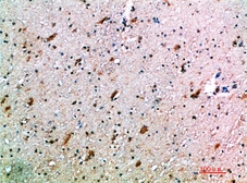 Anti-NKG2D antibody used in IHC (Paraffin sections) (IHC-P). GTX34027