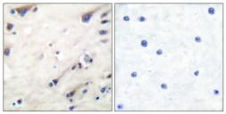 Anti-KSR1 antibody used in IHC (Paraffin sections) (IHC-P). GTX34028