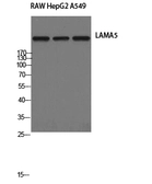 Anti-Laminin alpha 5 antibody used in Western Blot (WB). GTX34029
