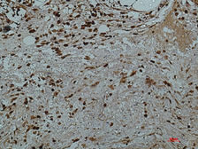 Anti-Galectin 3 antibody [8D7] used in IHC (Paraffin sections) (IHC-P). GTX34031