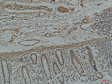 Anti-Galectin 3 antibody [5D9] used in IHC (Paraffin sections) (IHC-P). GTX34032
