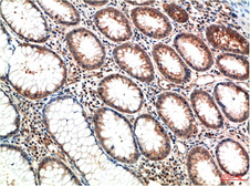 Anti-ATM antibody [1D1] used in IHC (Paraffin sections) (IHC-P). GTX34046