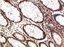 Anti-ATM antibody [3D3] used in IHC (Paraffin sections) (IHC-P). GTX34048