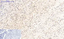 Anti-Bax antibody [6F11] used in IHC (Paraffin sections) (IHC-P). GTX34052