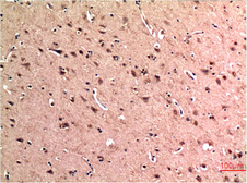 Anti-Beclin 1 antibody [5C2] used in IHC (Paraffin sections) (IHC-P). GTX34055