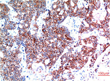 Anti-Beclin 1 antibody [5A11] used in IHC (Paraffin sections) (IHC-P). GTX34056