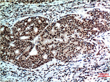 Anti-Beclin 1 antibody [5C5] used in IHC (Paraffin sections) (IHC-P). GTX34057