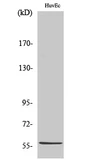 Anti-BEND4 antibody used in Western Blot (WB). GTX34058