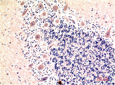 Anti-LC3B antibody [9H5] used in IHC (Paraffin sections) (IHC-P). GTX34068