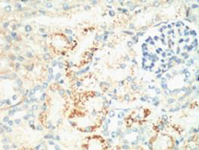 Anti-Ki67 antibody [4A8] used in IHC (Paraffin sections) (IHC-P). GTX34077