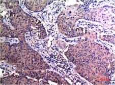 Anti-MMP2 antibody [1H1] used in IHC (Paraffin sections) (IHC-P). GTX34081