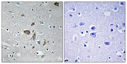 Anti-NDUFA4 antibody used in IHC (Paraffin sections) (IHC-P). GTX34093