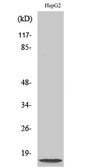 Anti-NDUFA4L2 antibody used in Western Blot (WB). GTX34094