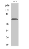 Anti-NEI3 antibody used in Western Blot (WB). GTX34095