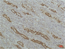 Anti-IKB beta antibody [8D11] used in IHC (Paraffin sections) (IHC-P). GTX34099
