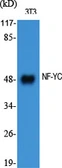 Anti-NFYC antibody used in Western Blot (WB). GTX34100