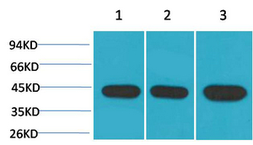 Anti-alpha Smooth Muscle Actin antibody [1E12] used in Western Blot (WB). GTX34110