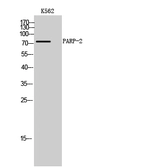 Anti-PARP2 antibody used in Western Blot (WB). GTX34116