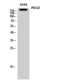 Anti-PEG3 antibody used in Western Blot (WB). GTX34119