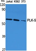 Anti-PLK5 antibody used in Western Blot (WB). GTX34126