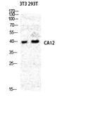 Anti-Carbonic Anhydrase XII antibody used in Western Blot (WB). GTX34128