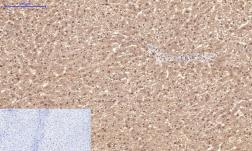 Anti-PPAR delta antibody [2F9] used in IHC (Paraffin sections) (IHC-P). GTX34133