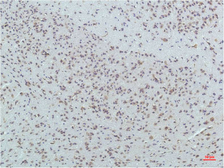 Anti-PPAR delta antibody [1D7] used in IHC (Paraffin sections) (IHC-P). GTX34134